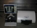 Kodak Orex PcCR 1417 ACL4 Digital X-ray