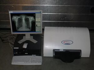 Kodak Orex PcCR 1417 ACL4 Digital X-ray